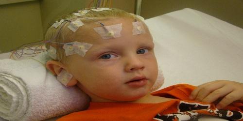 Bebeklerde EEG Nasl ekilir?